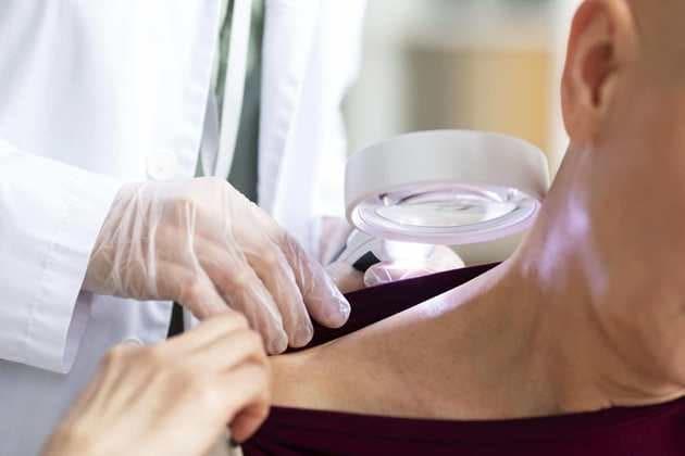 ALERTA: Conheça mitos e verdades sobre o câncer de pele